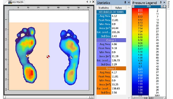 XSENSOR Stance Pad - Summit Medical & Scientific