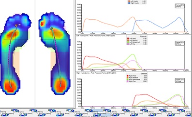 Assess and profile players in team sports using X4 Intelligent Insoles