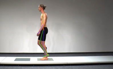 Box Icon Gait Analysis